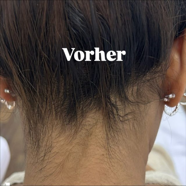 Dank dauerhafter Haarentfernung ist die Haut glatt, gepflegt und langanhaltend haarfrei. Kein ständiges Rasieren mehr – stattdessen spürbar mehr Komfort, Zeitersparnis und ein rundum gepflegtes Hautgefühl. 🥰✨🤞🏽
Bist du schon Haarfrei ? 👀