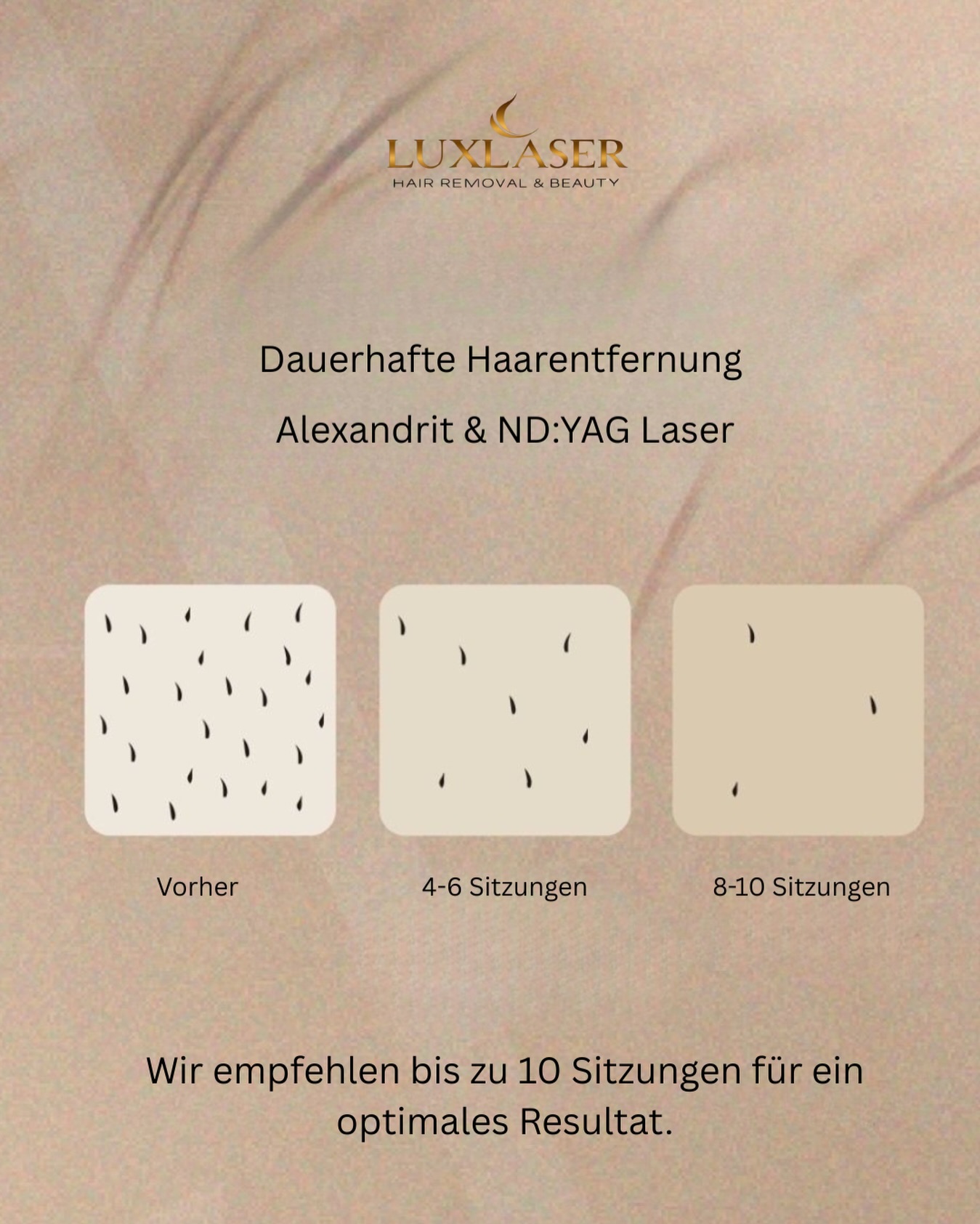 ✨ Sichtbare Ergebnisse von Sitzung zu Sitzung ✨

Bei jeder Behandlung werden die Haare spürbar und sichtbar weniger.
Von Sitzung zu Sitzung wachsen sie feiner nach, werden lichter und fallen zunehmend aus. 🌿

Für ein optimales und langanhaltendes Ergebnis empfehlen wir ca. 10 Sitzungen, da sich die Haare in unterschiedlichen Wachstumsphasen befinden. Nur so können alle Haarwurzeln effektiv behandelt werden.

Geduld zahlt sich aus – Schritt für Schritt zu glatter Haut! 💫